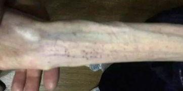 吃瓜恶心事件解剖